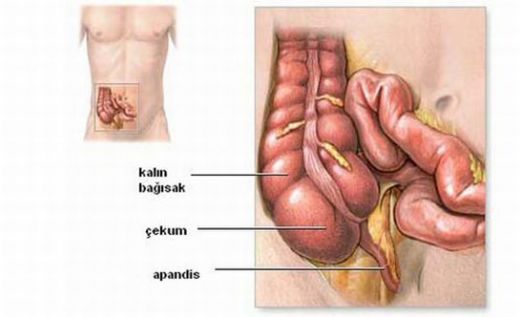 Apandisit Ameliyat Sonras Beslenme