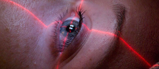 Lazer Göz Ameliyatı